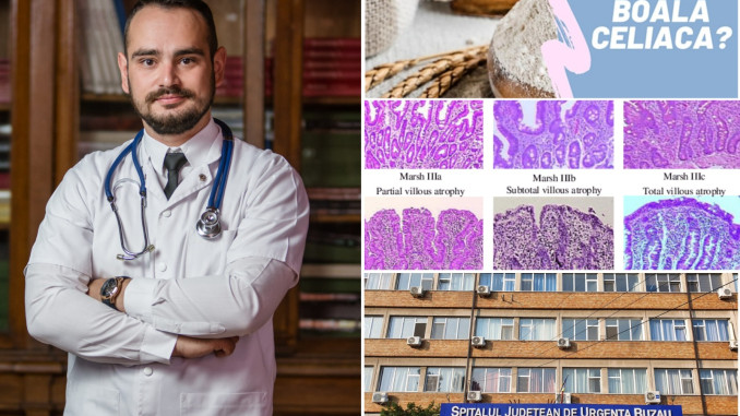 celiaca